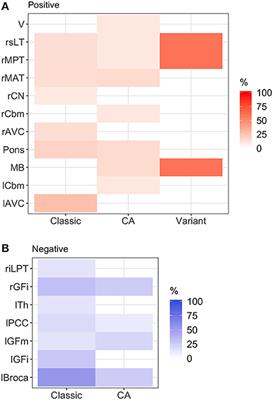 Brain and Muscle Metabolic Changes by FDG-PET in Stiff Person Syndrome Spectrum Disorders